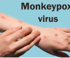 Alert regarding Monkeypox in Uttarakhand too, symptoms are like smallpox, virus spreads through sneezing and coughing